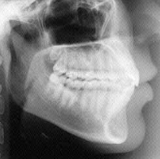 Radiologia Odontológica em Cariacica